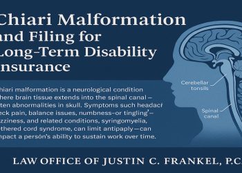 Chiari Malformation Lengthy-Time period Incapacity Claims Information