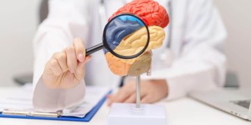 Neurological Problems That Qualify for Lengthy-Time period Incapacity